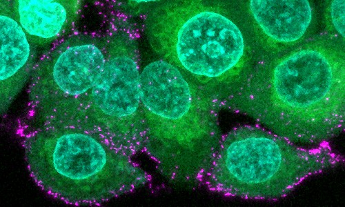 Image of human epithelial cells (green with blue nuclei) are incubated with synthetic SARS-CoV-2 virions (magenta) to study infection and immune evasion.